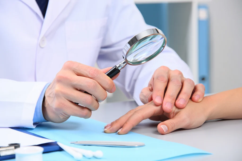 Dermatologist examining peeling nail issues